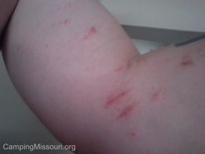 Poison Ivy Devil 2014-05-24 12.52.52